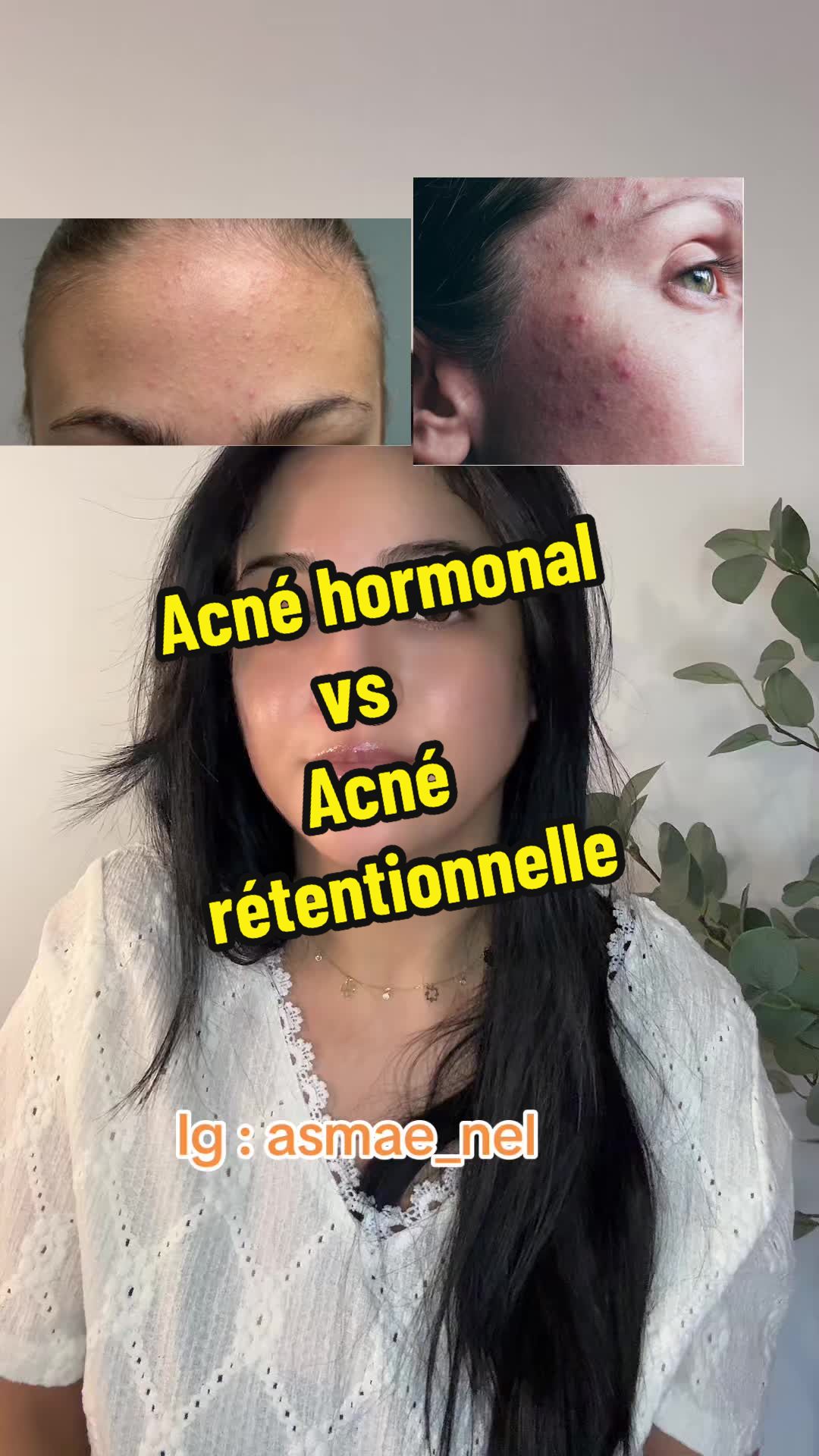 @Asmae🧚🏻|Skincare | Mom &🤰🏻