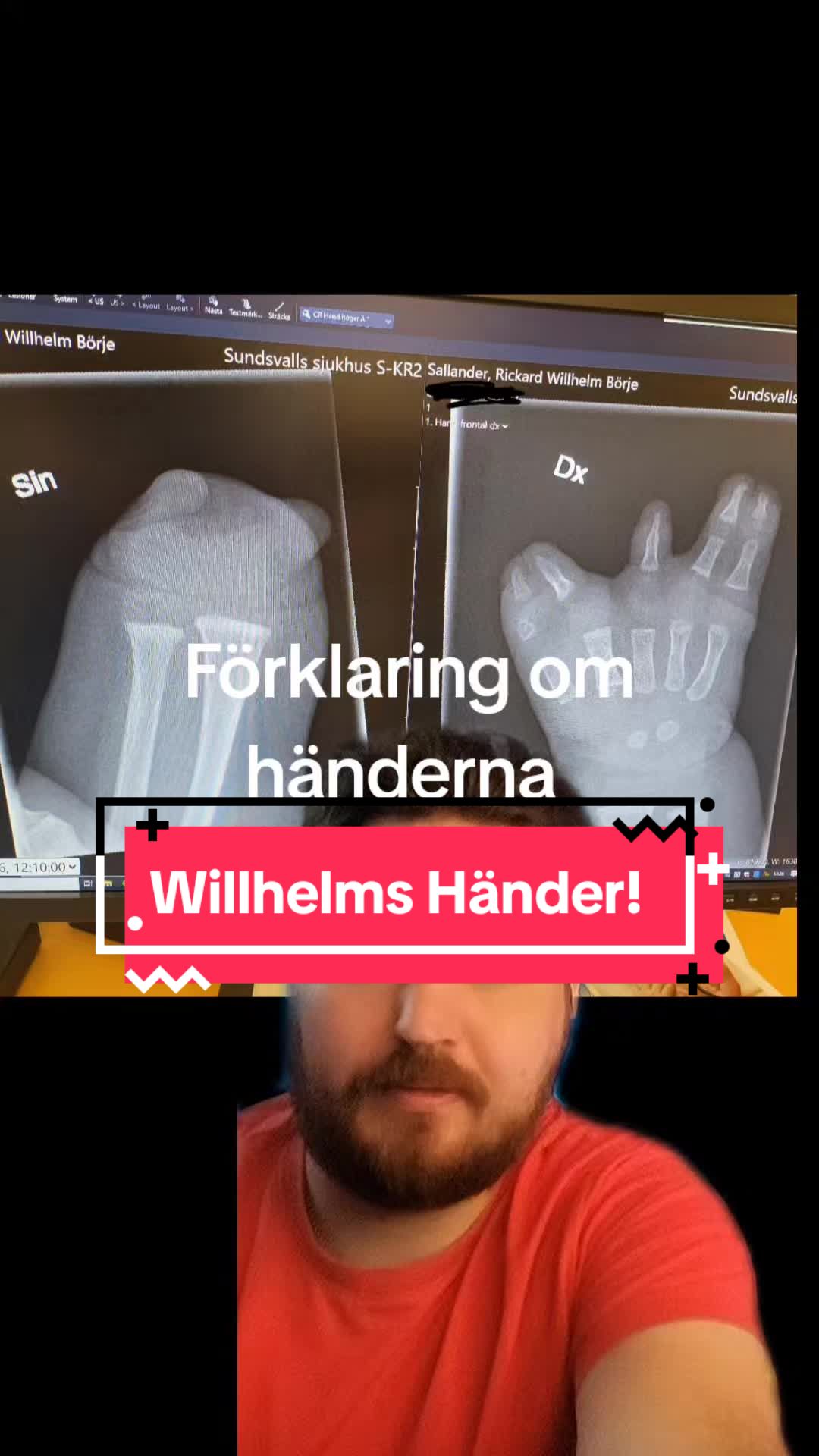 @Sallander