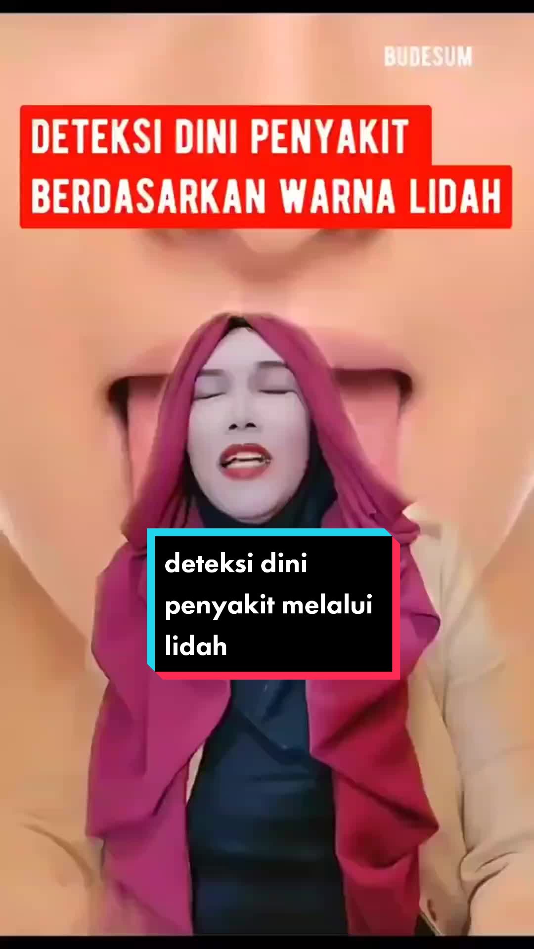 @budesum