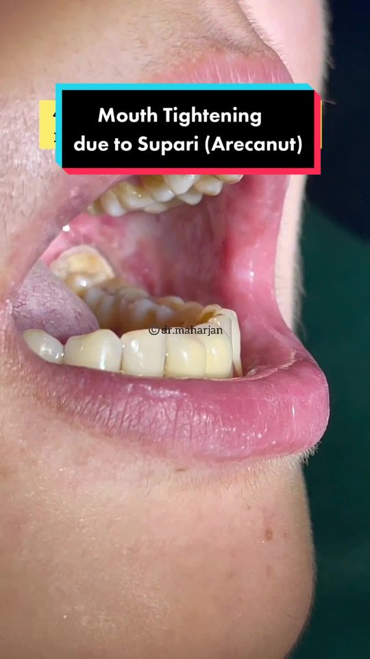 @SMaharjan