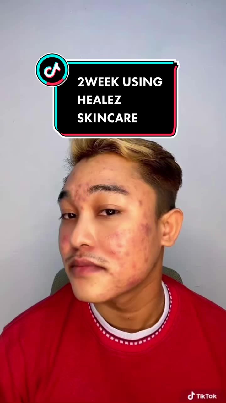 @๐๐ฒ๐๐ฆ๐๐๐ฅ ๐น