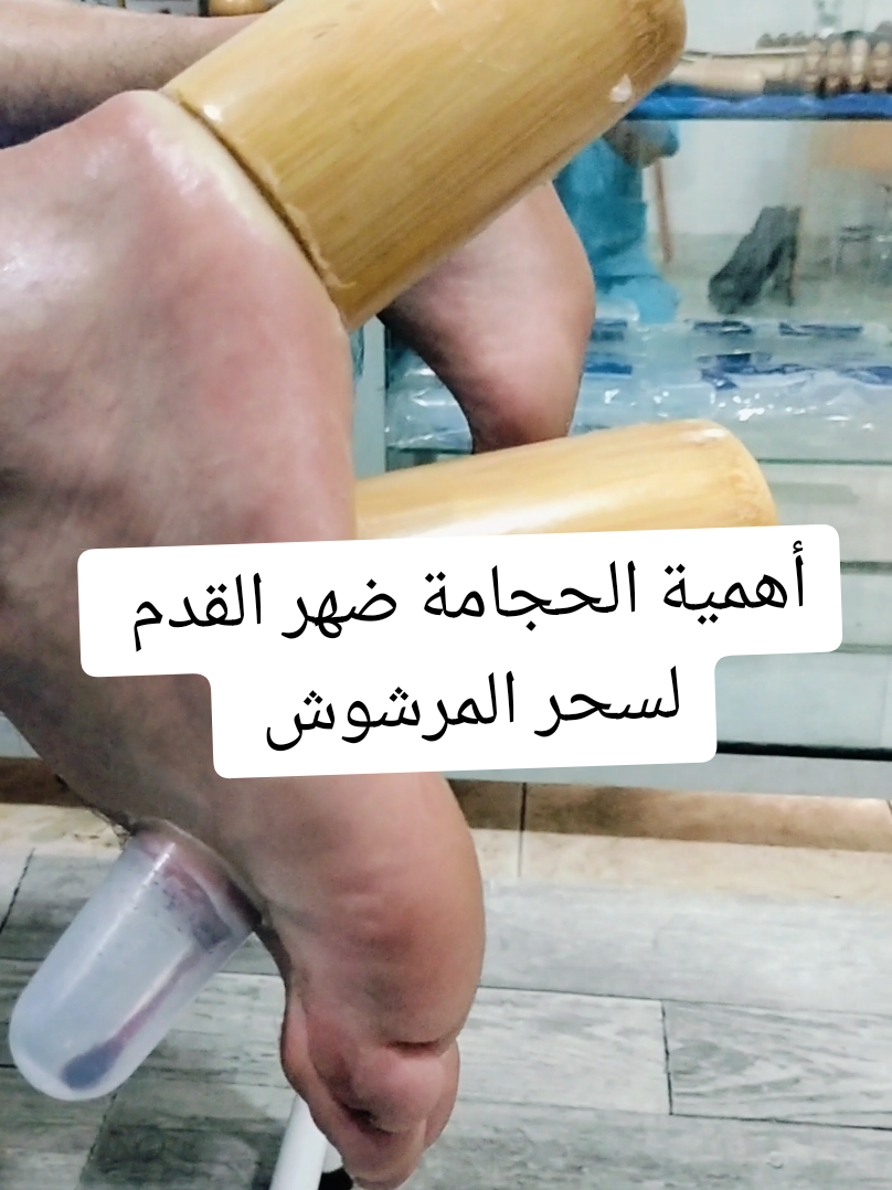 @مركز الأصيل للعناية الجسدية 2