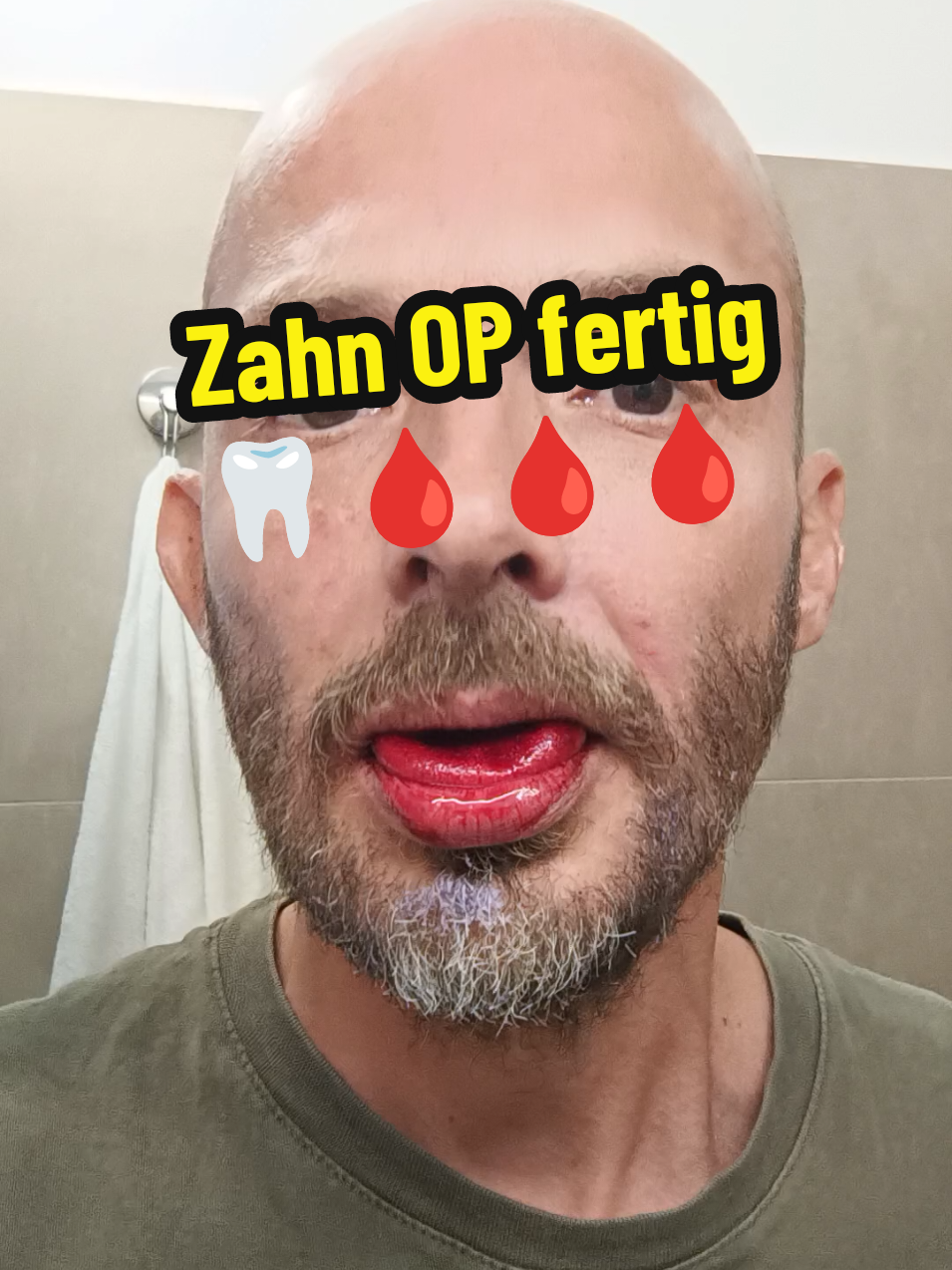 @berndout