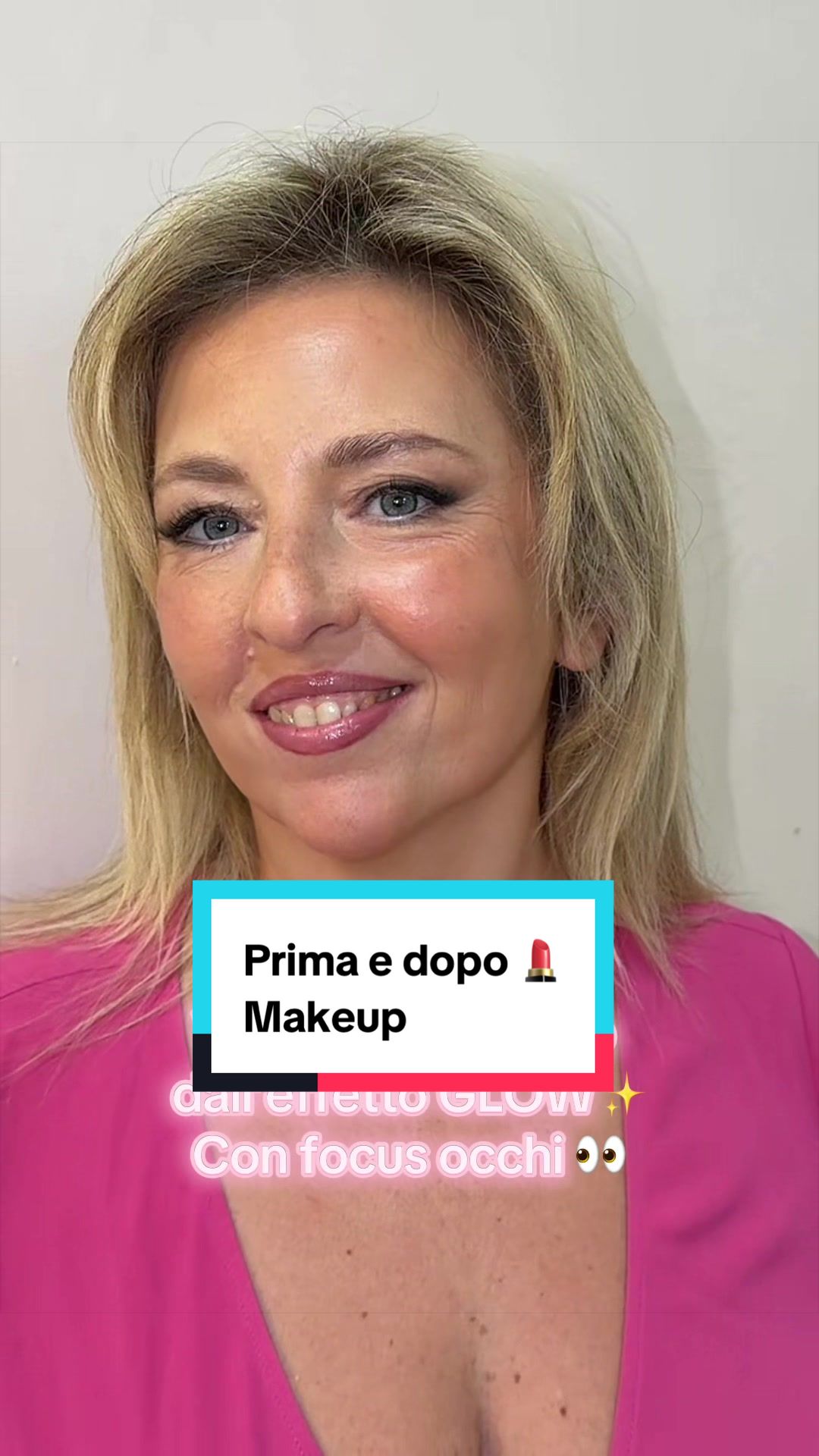 @Perla Guerriero