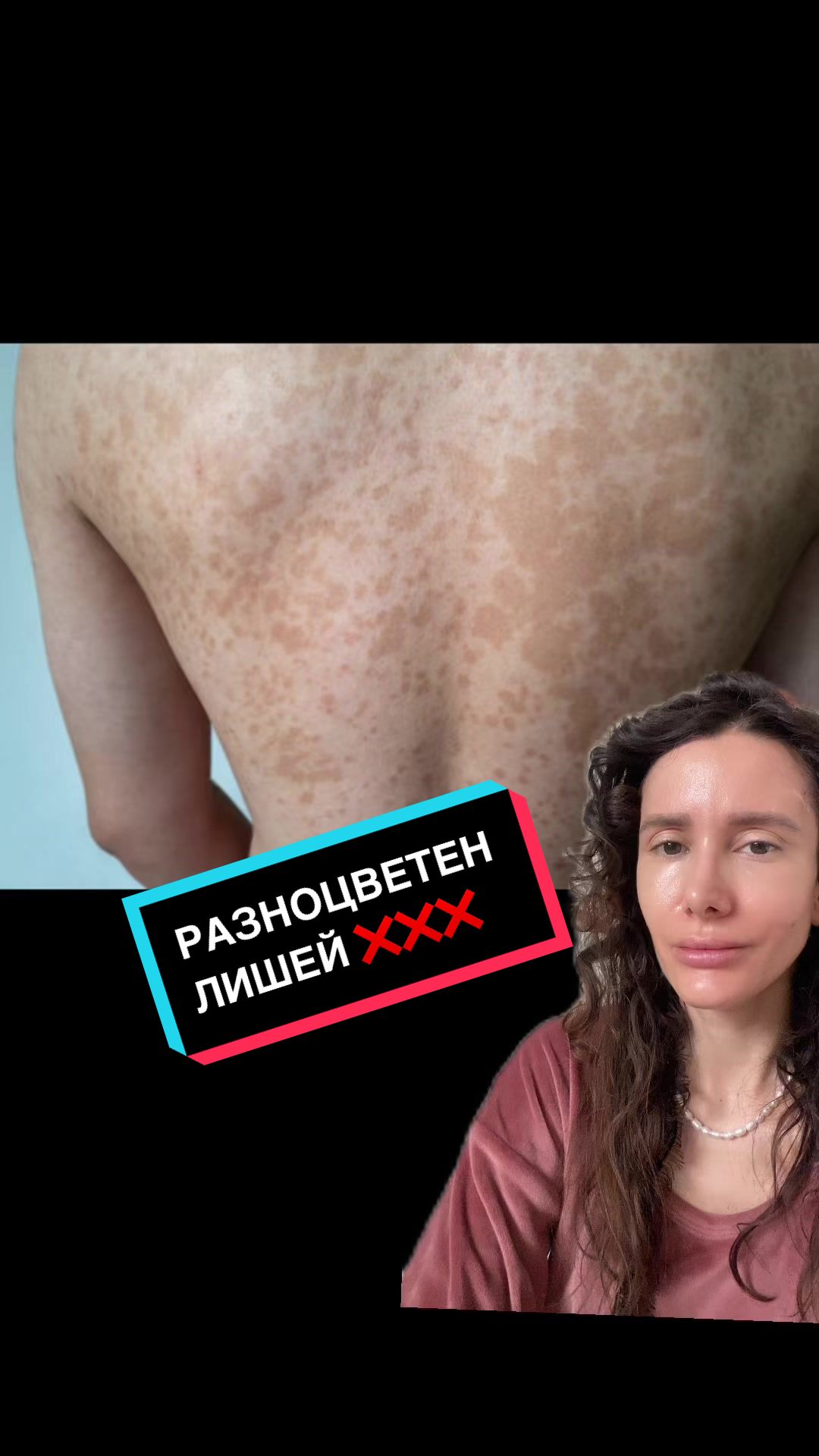 @💉👩🏻&zwj;⚕️ СкинТок Дерматолог