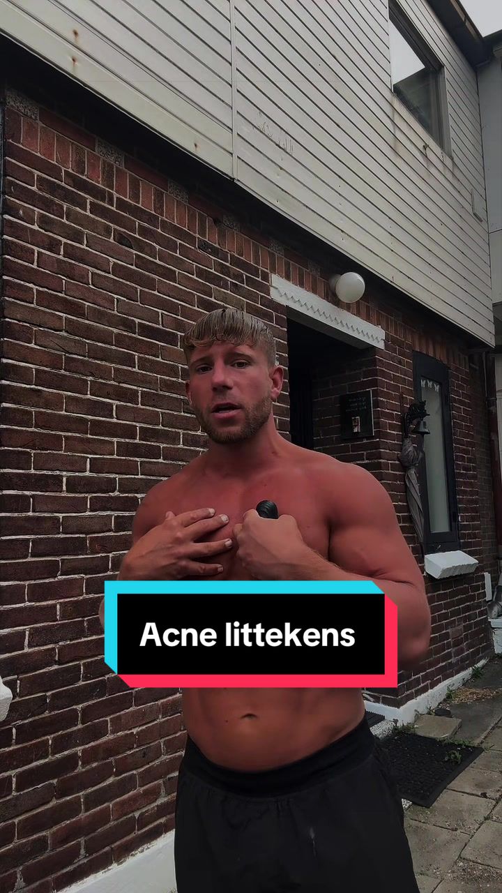 @Veinsking