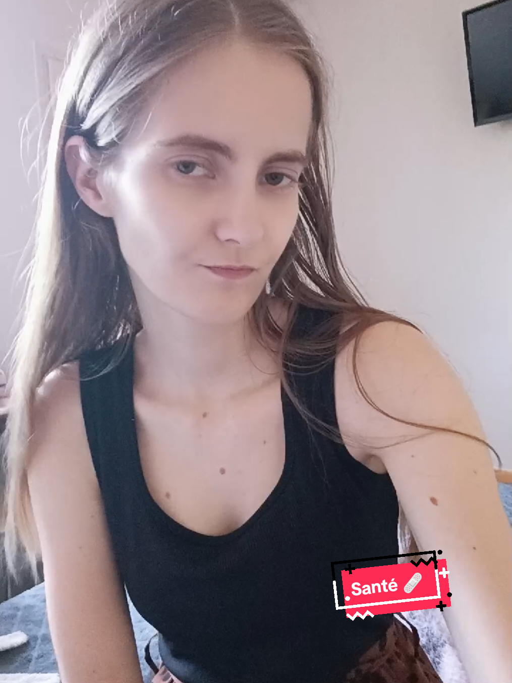 @Ray Laura 🎗️