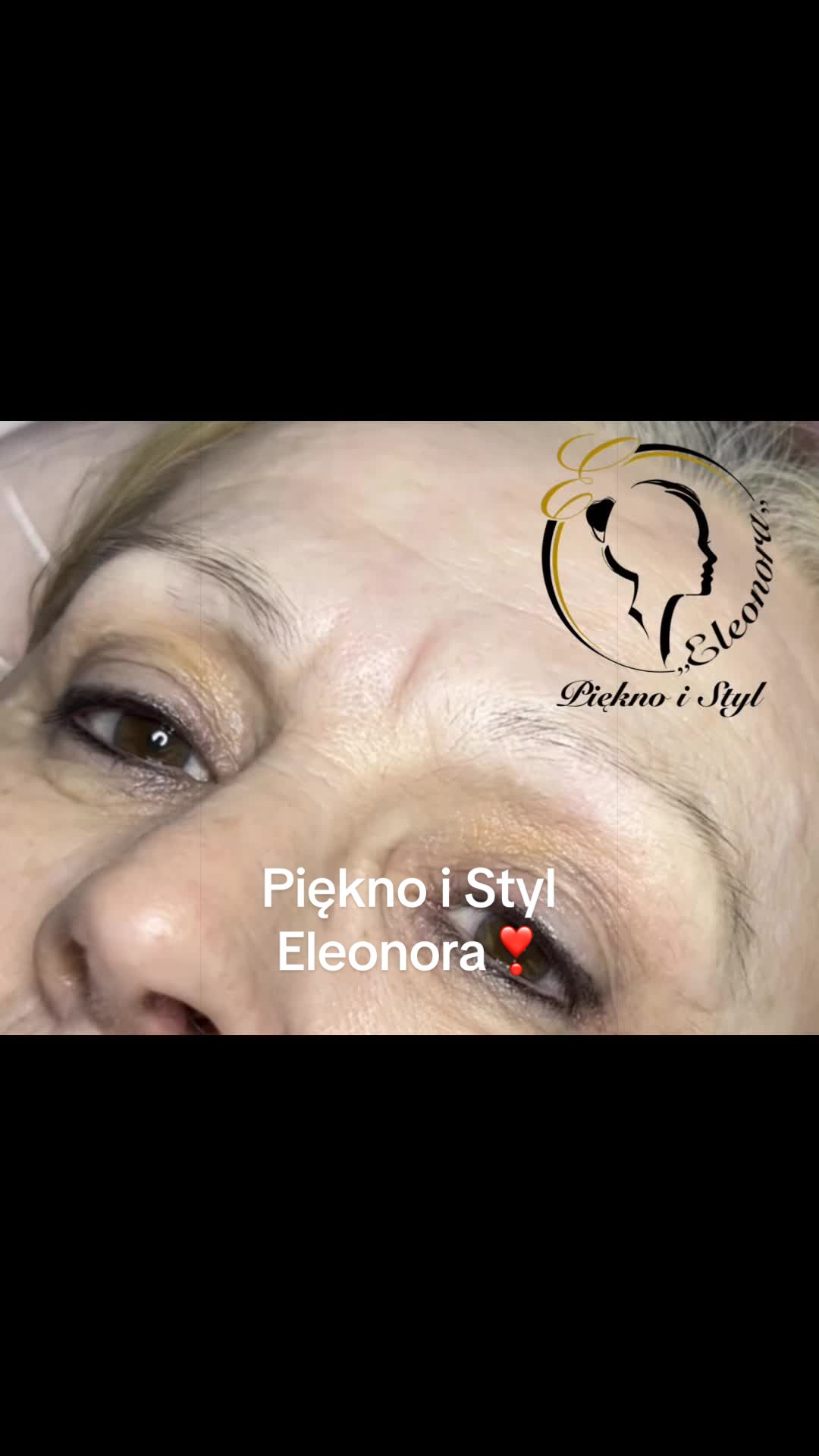 @elbietanycz0