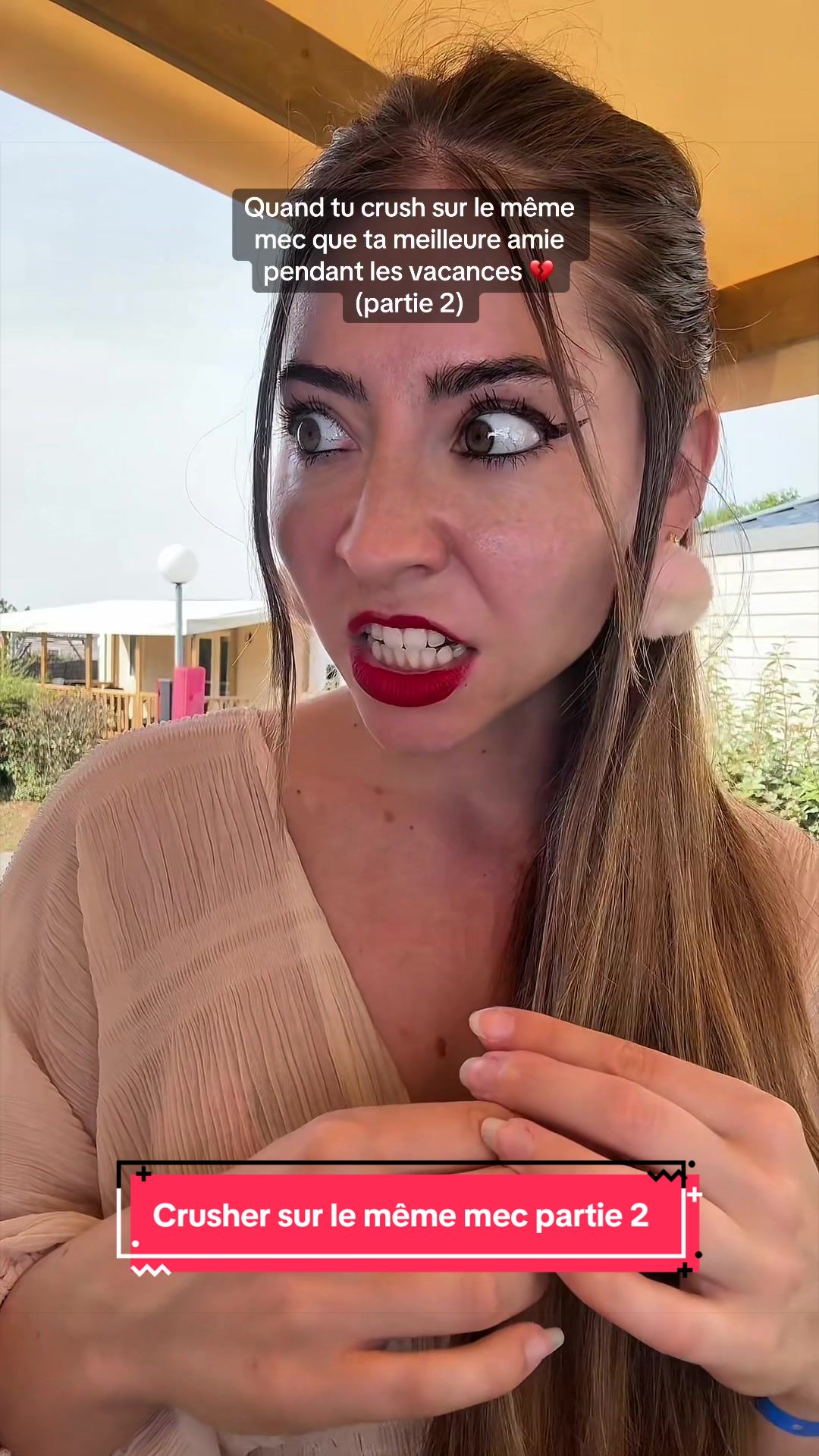 @Shayvise