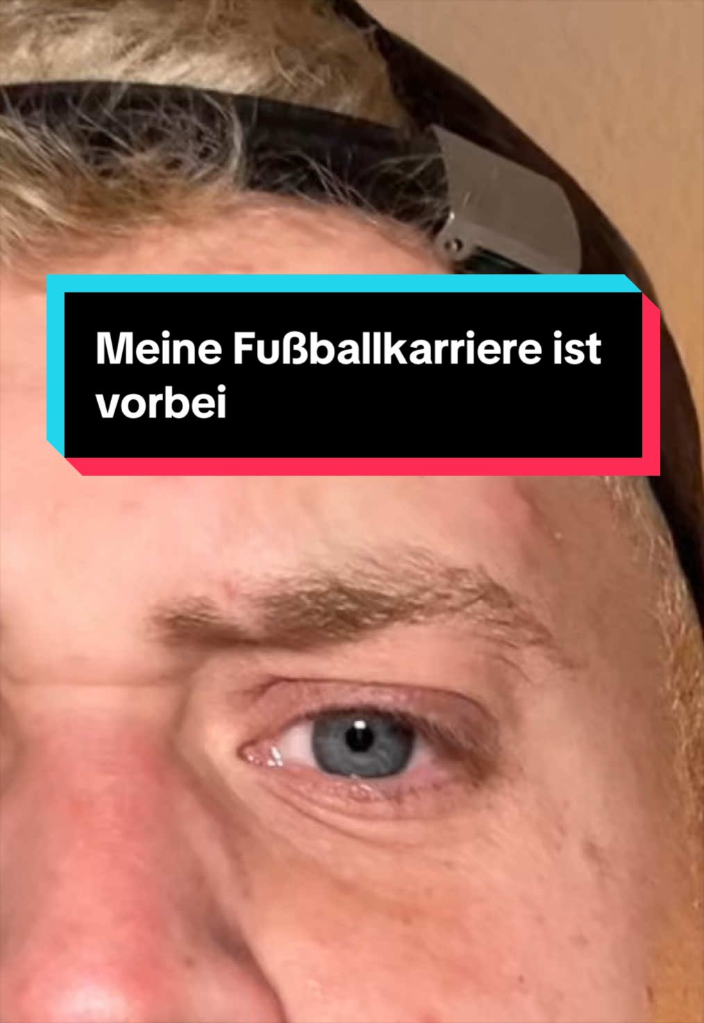 @Gildeon