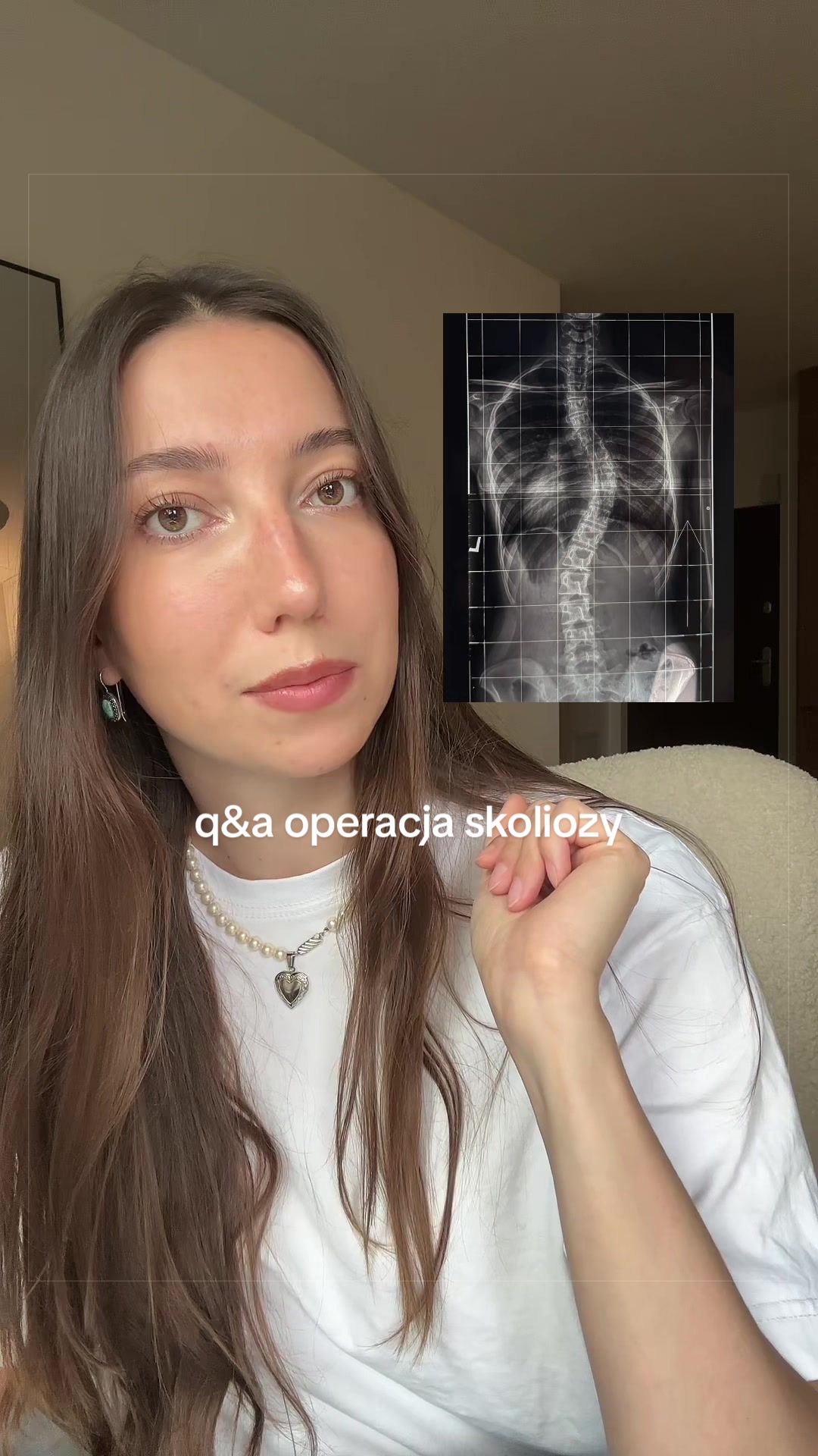 @Karolina Dobrowolska