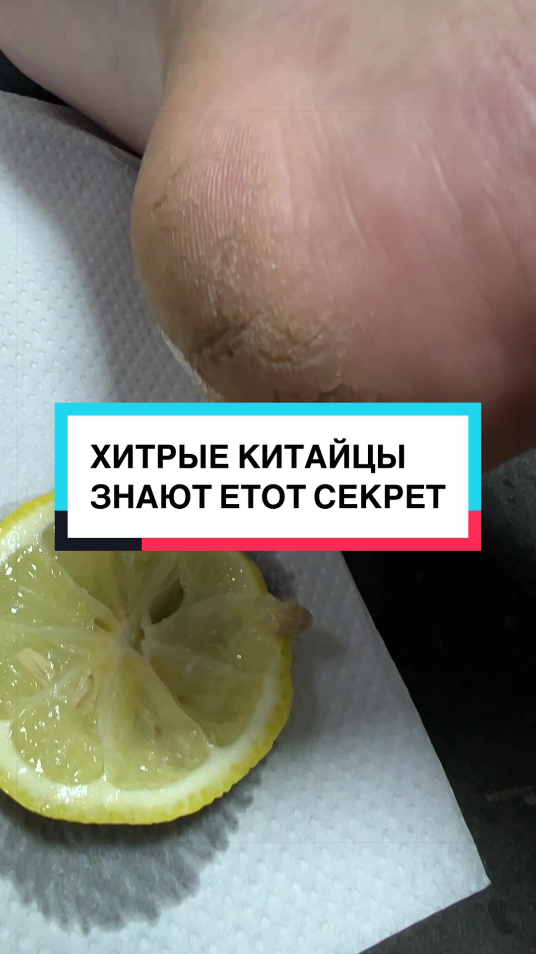 @laifhak_mozgi