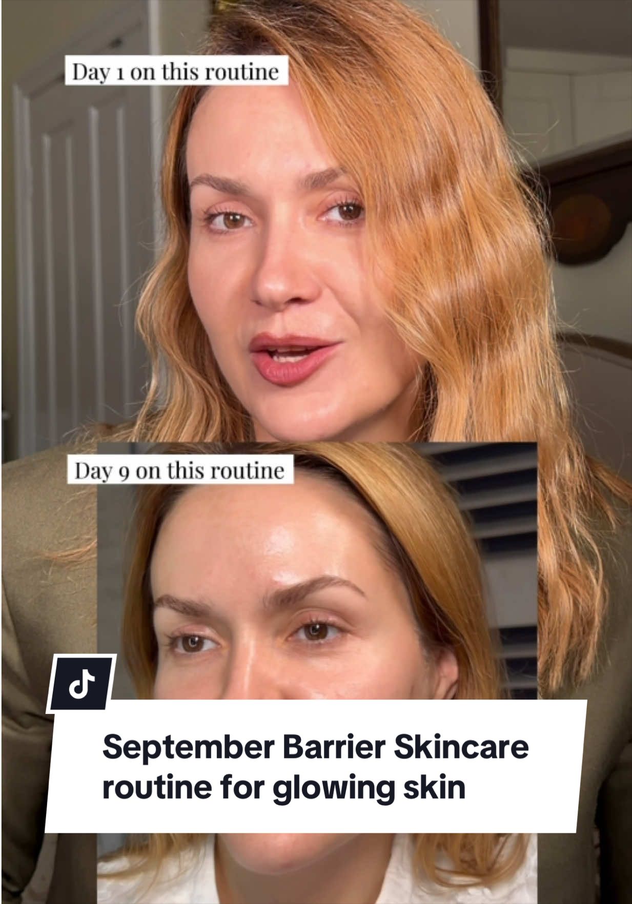 @Marina @4complexion
