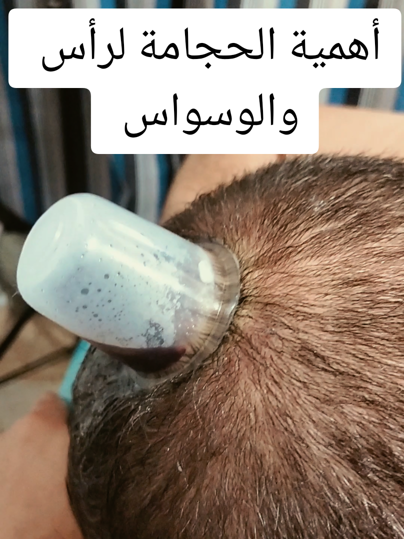 @مركز الأصيل للعناية الجسدية 2