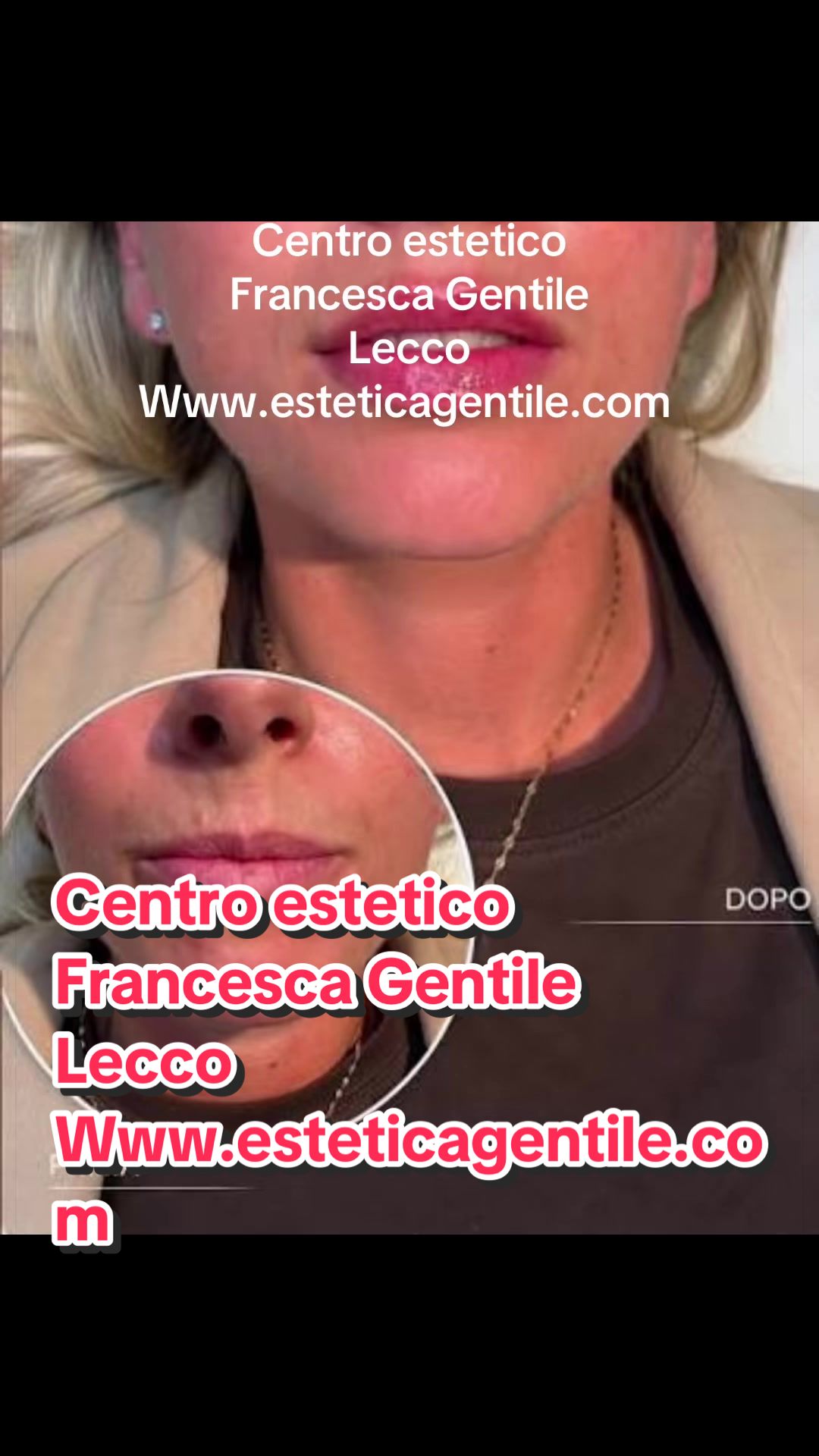 @Francesca Gentile