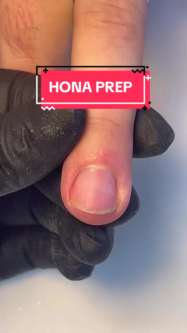@HONA