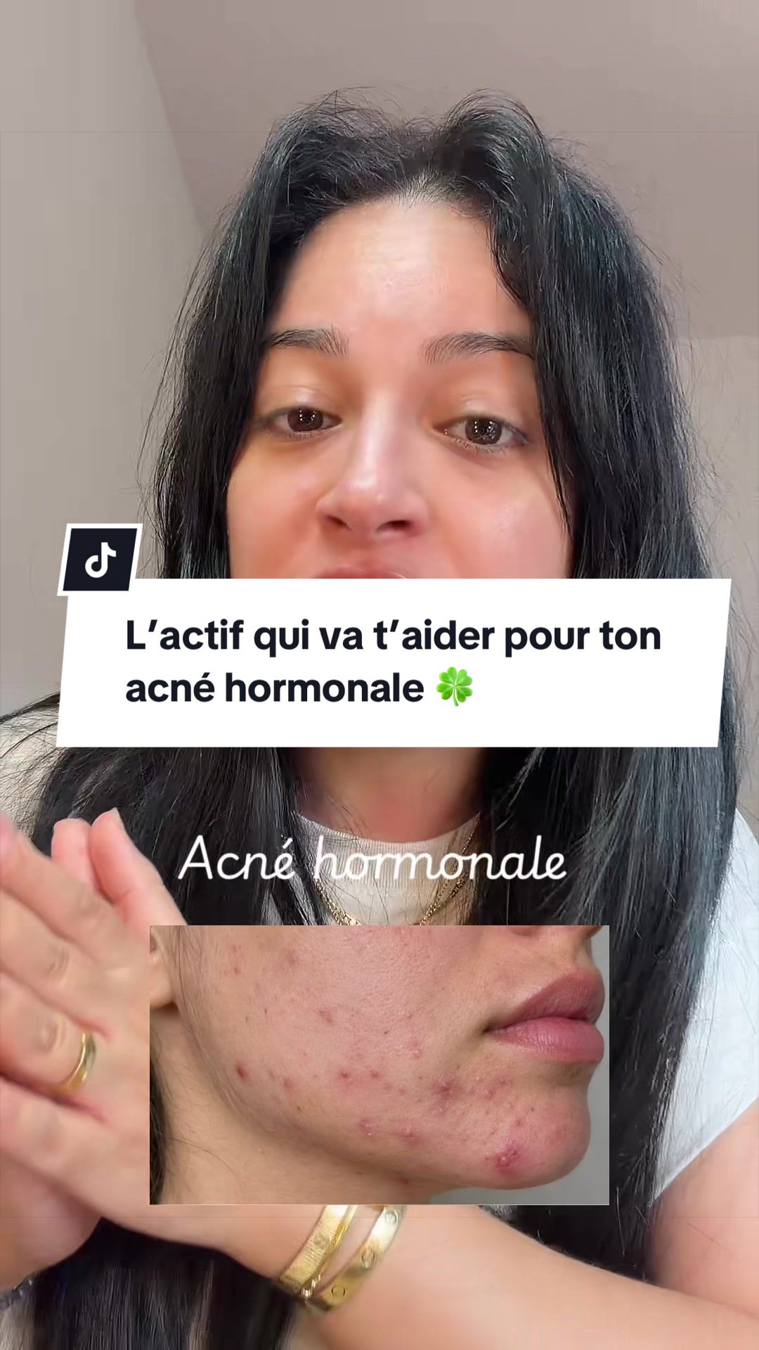 @Asmae |Skincare🫧|Mom of G&I🩵