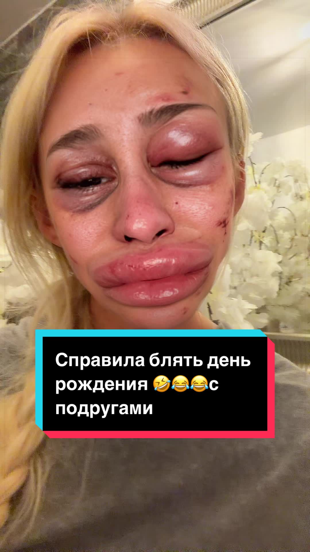 @Solnze 23