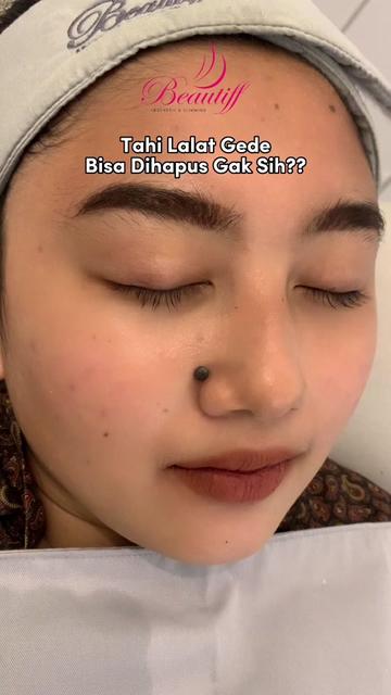 @Beautiff Clinic