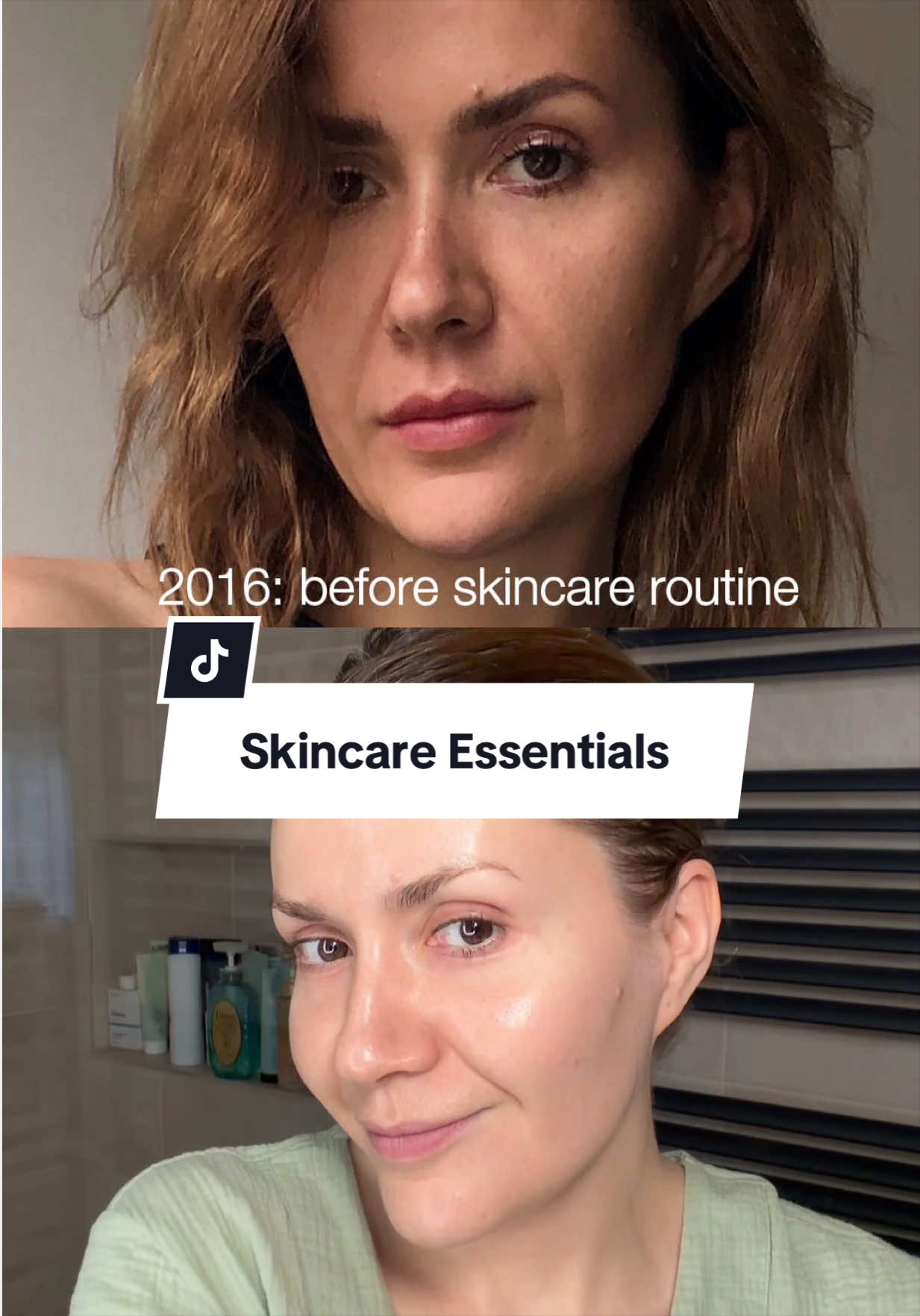 @Marina @4complexion