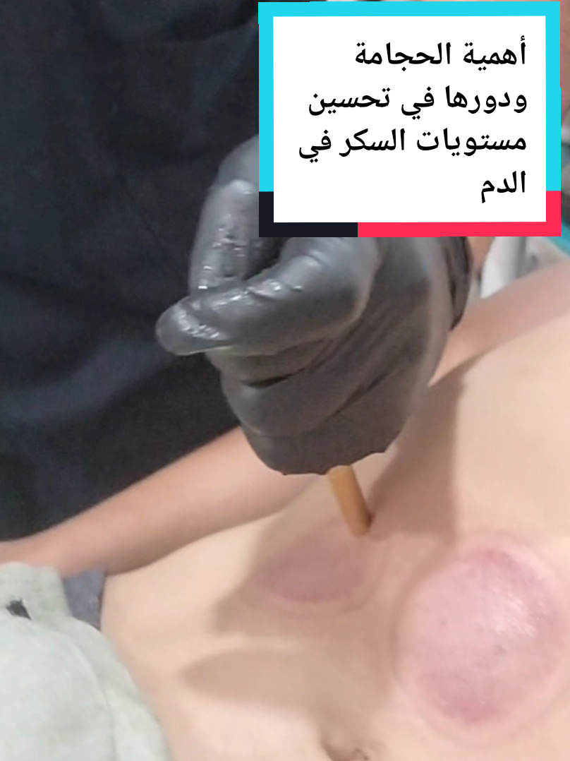 @مركز الأصيل للعناية الجسدية 2