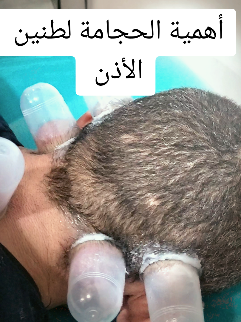 @مركز الأصيل للعناية الجسدية 2