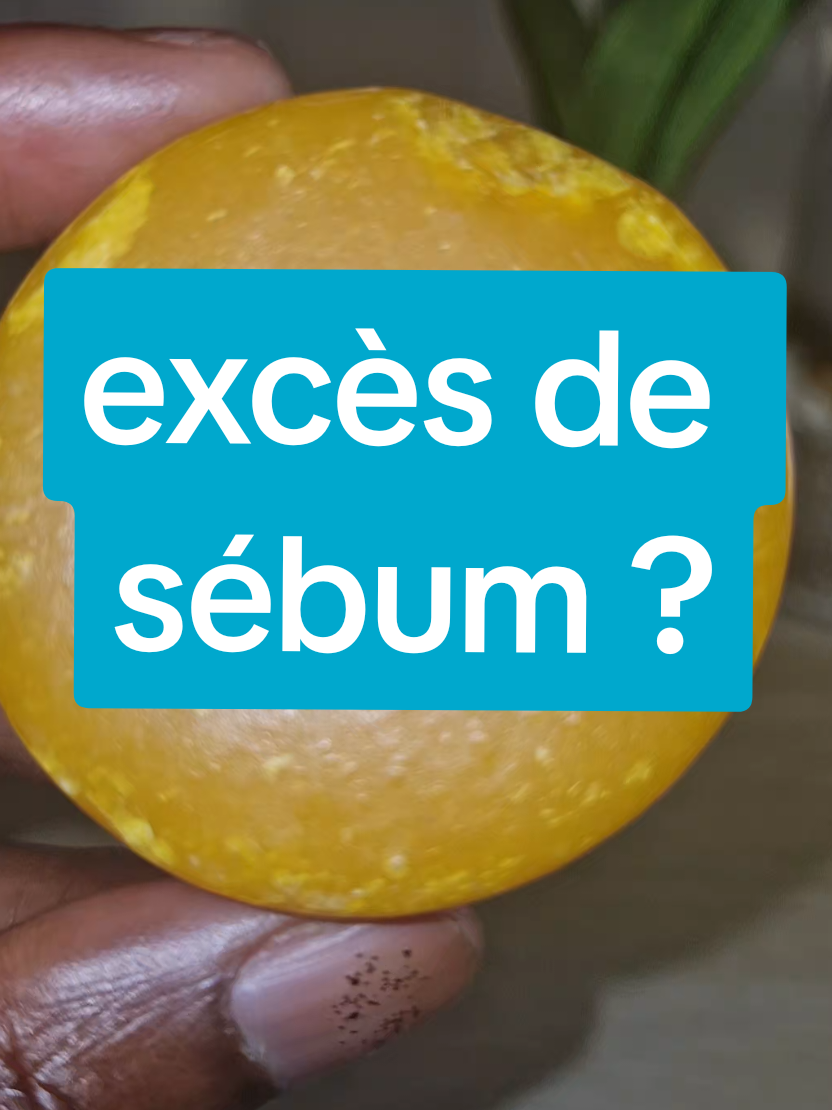 @abbies_gestion stress