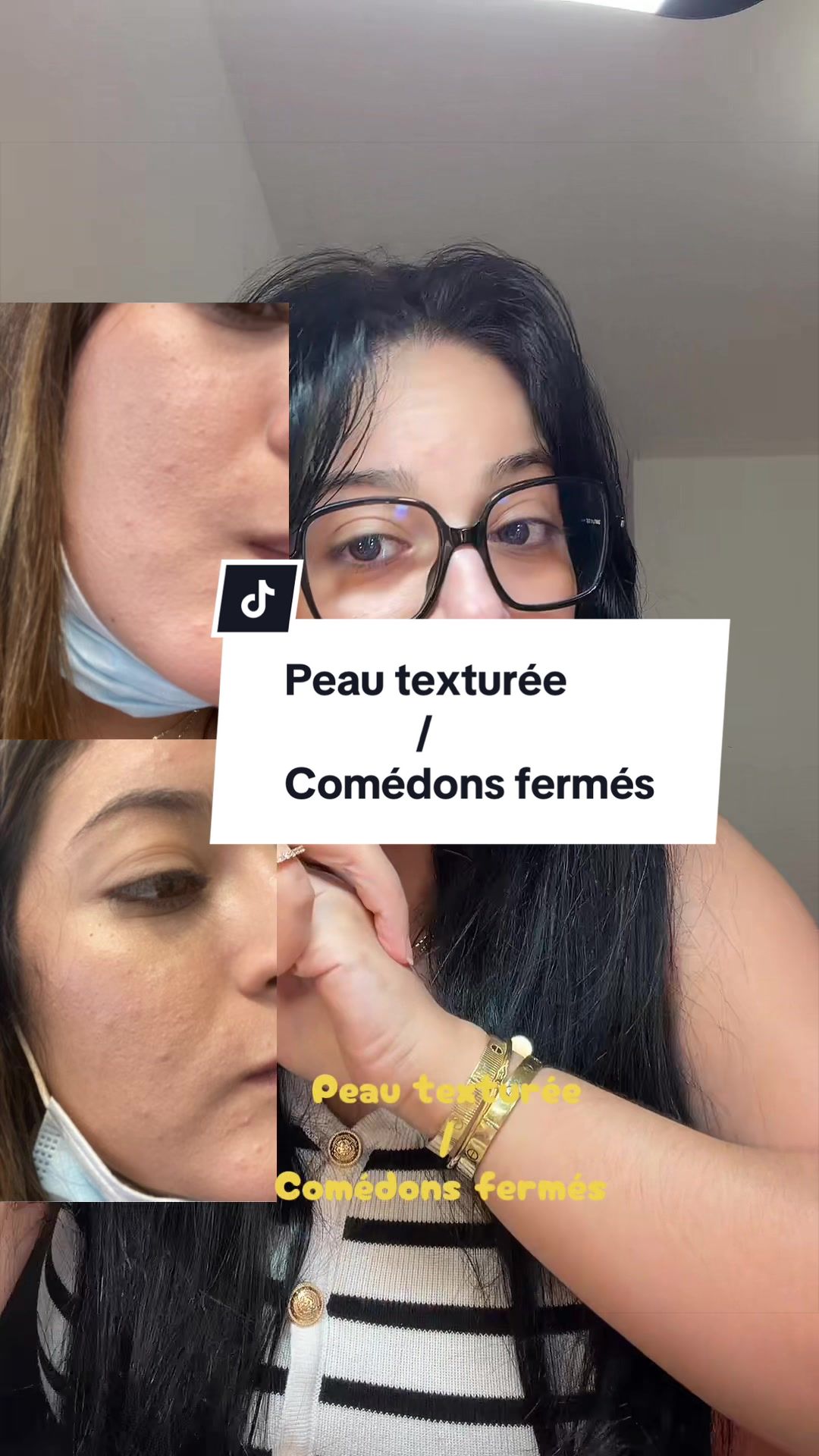 @Asmae |Skincare🫧|Mom of G&I🩵