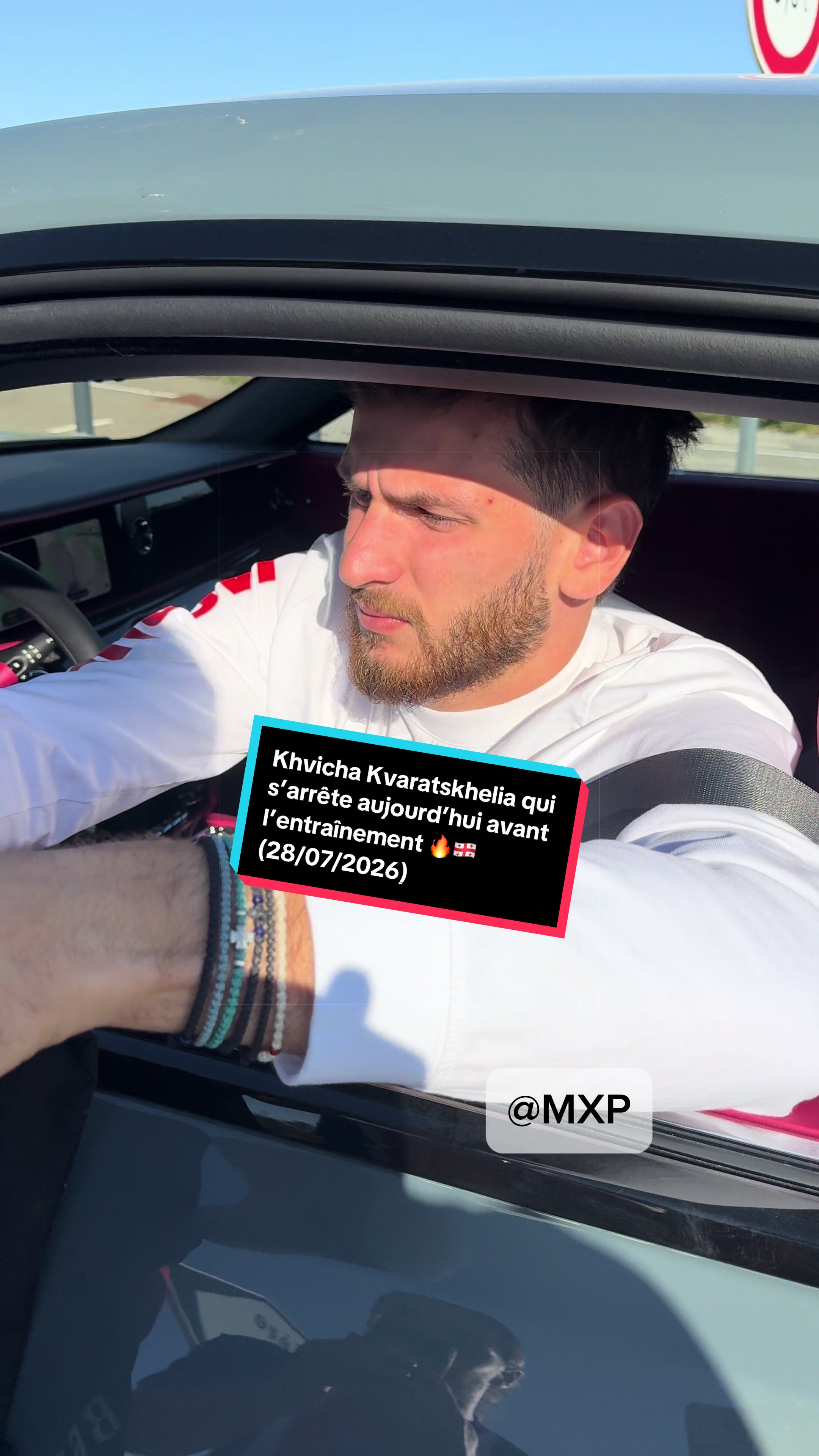 @MXP