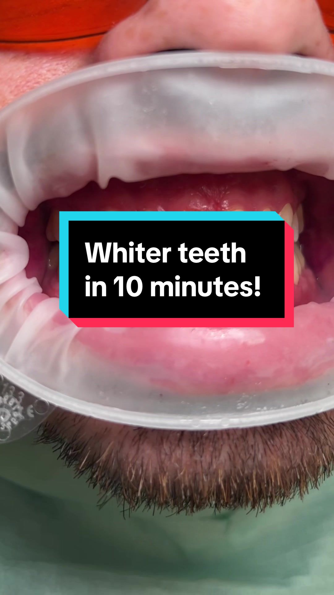 @londonhygienist