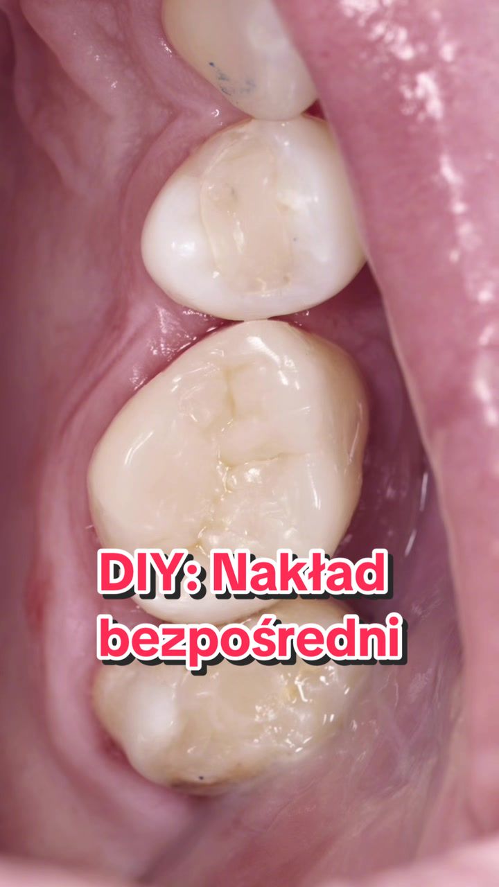 @Anna 🦷 dentystka