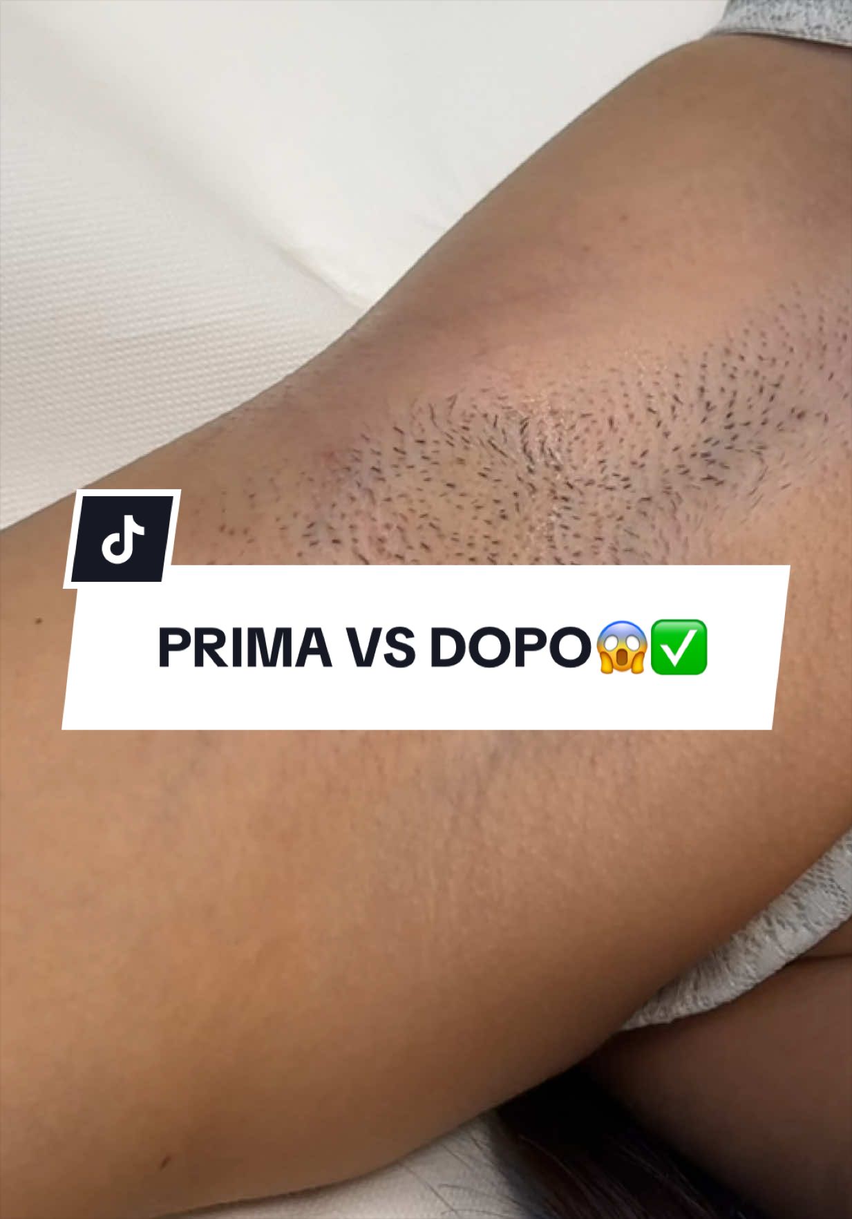 @epilambra