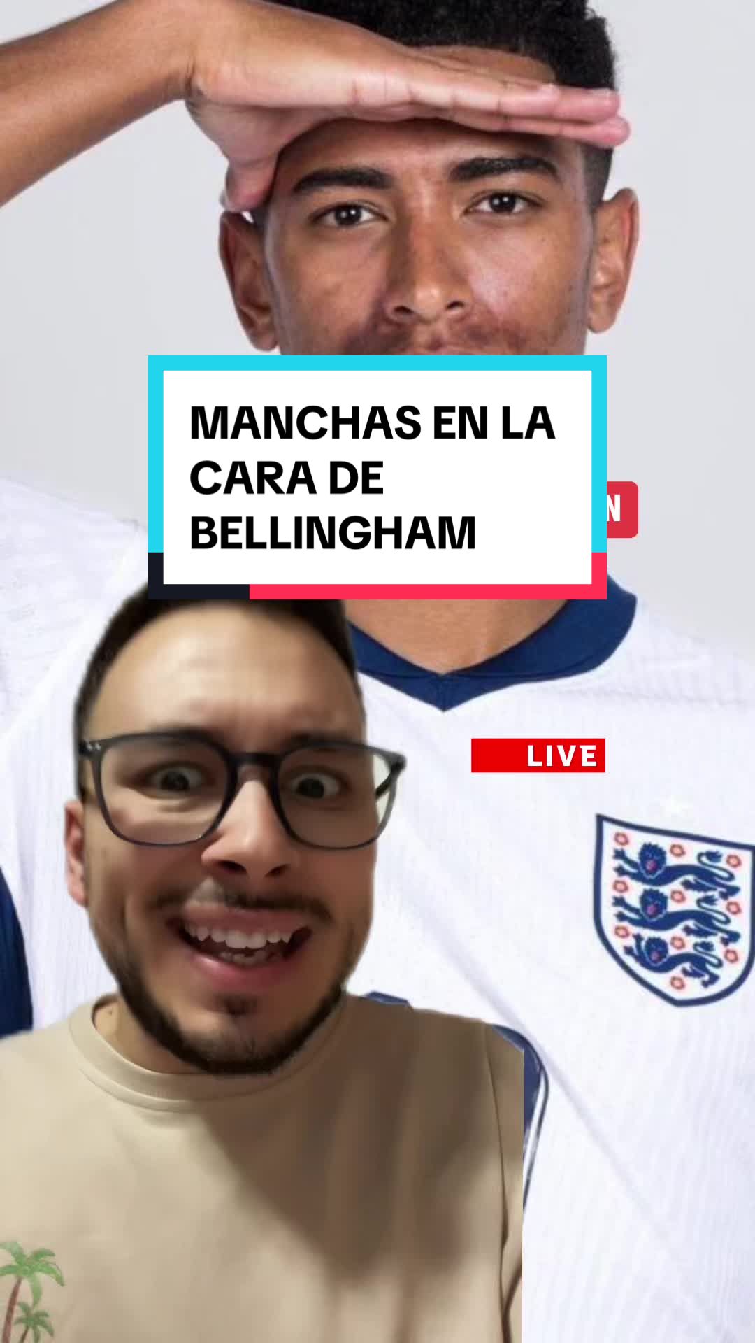 @Carlos Medina