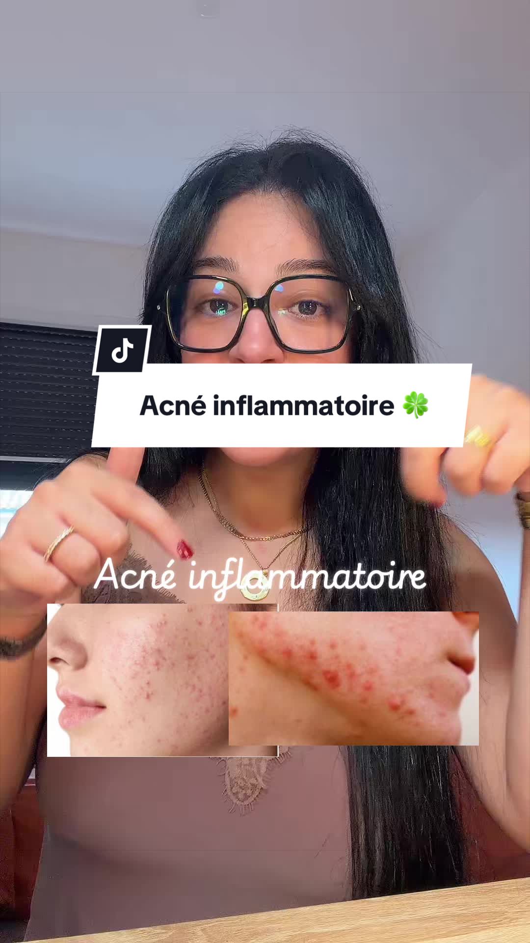 @Asmae |Skincare🫧|Mom of G&I🩵