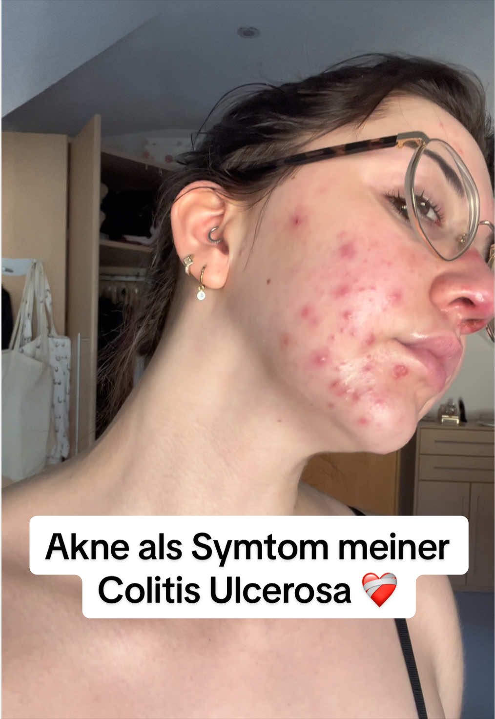 @Julia