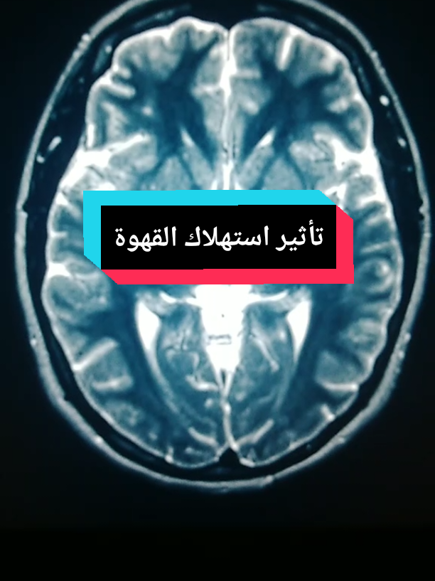 @Free Minds | العقول المتحررة💡