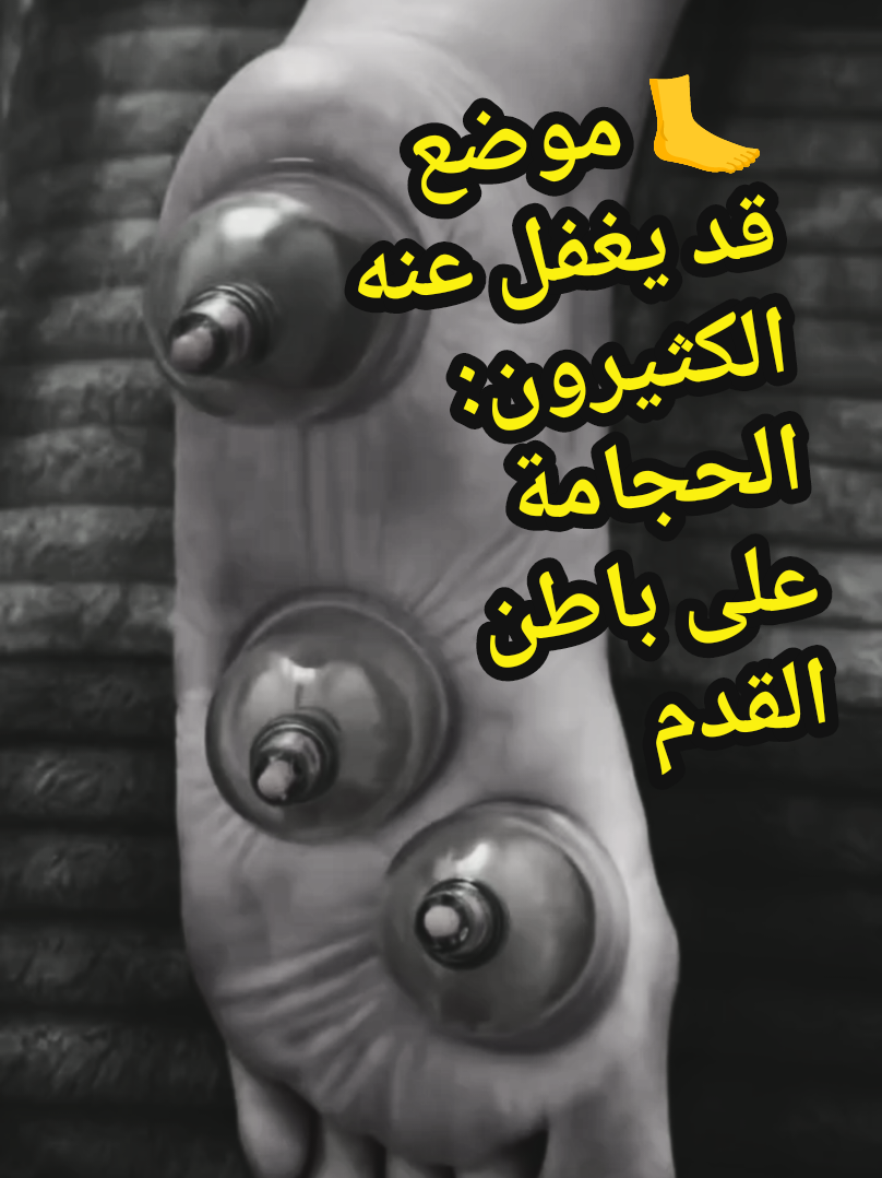 @مركز الأصيل للعناية الجسدية 2