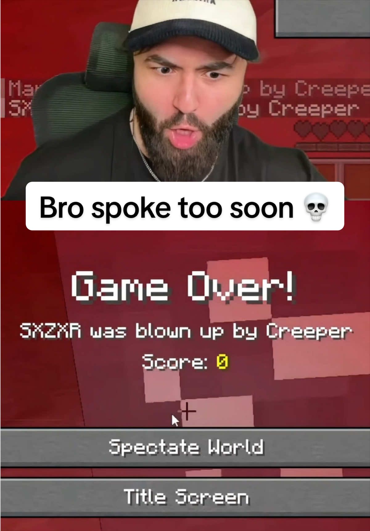 @Sxzxr