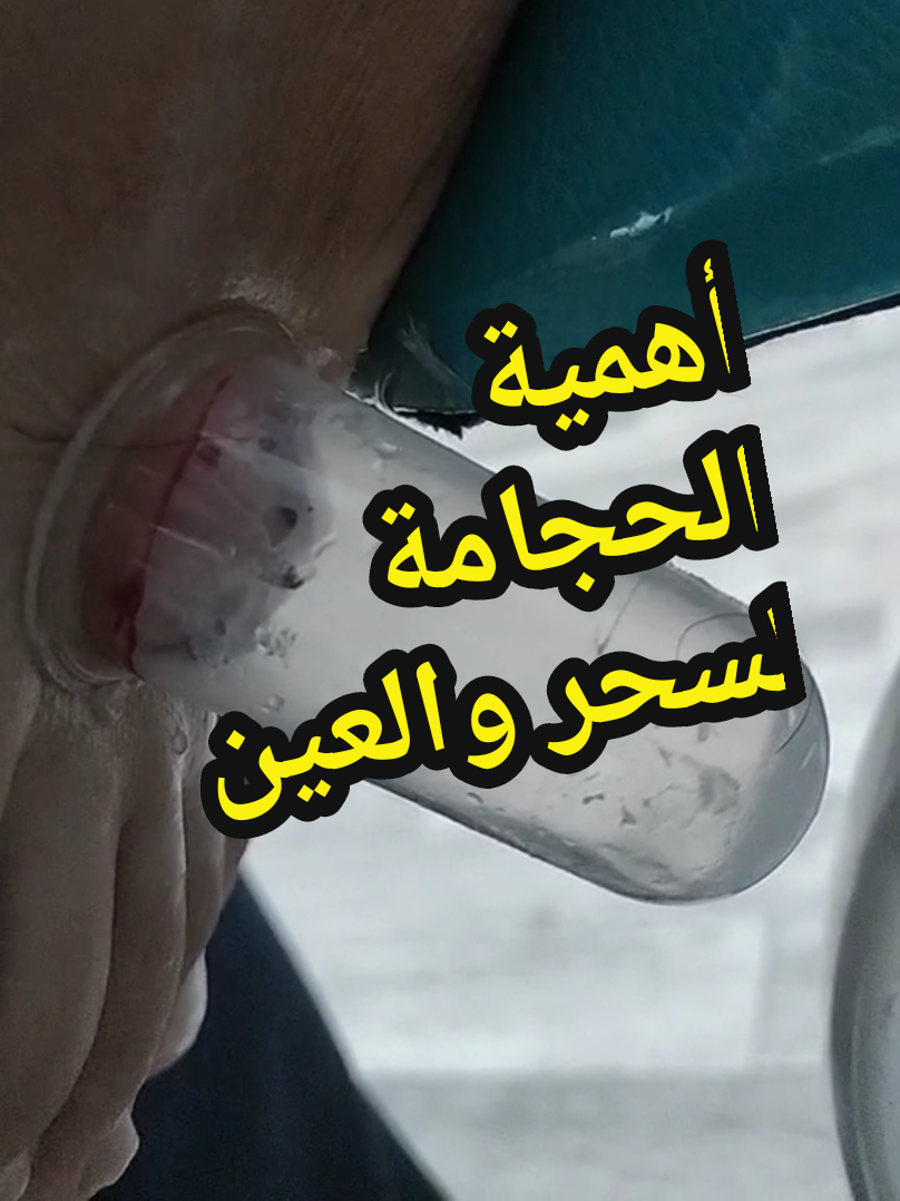 @مركز الأصيل للعناية الجسدية 2