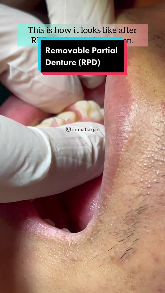 @SMaharjan