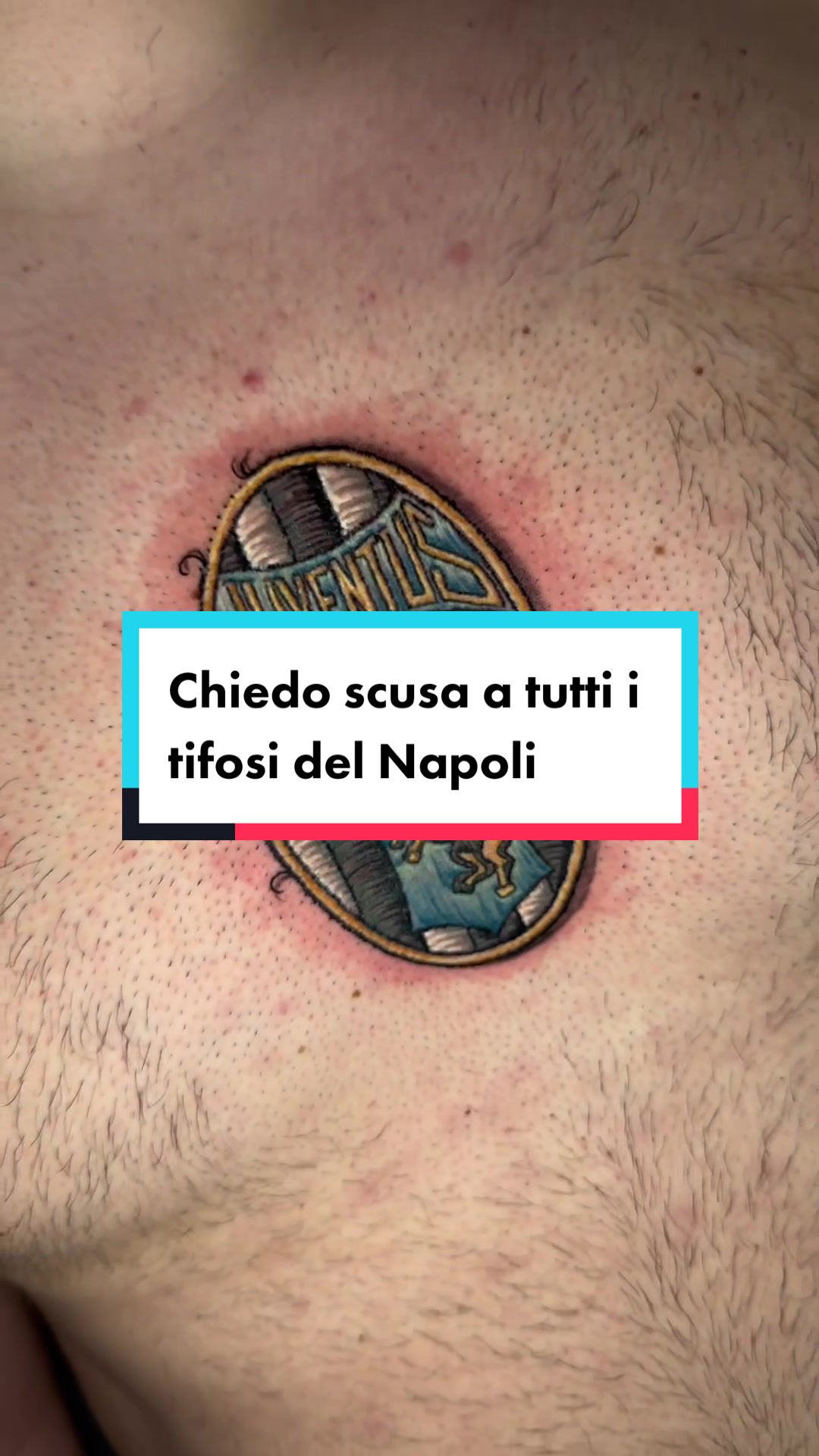 @Erot1