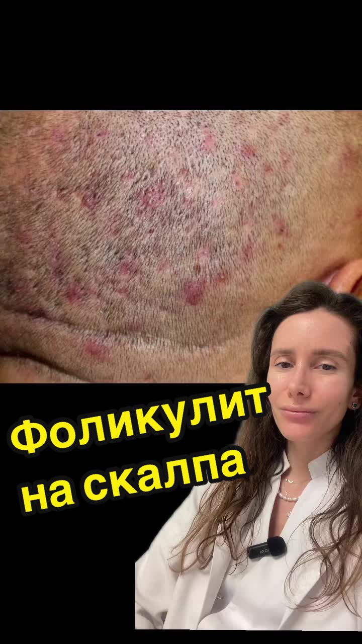 @💉👩🏻&zwj;⚕️ СкинТок Дерматолог