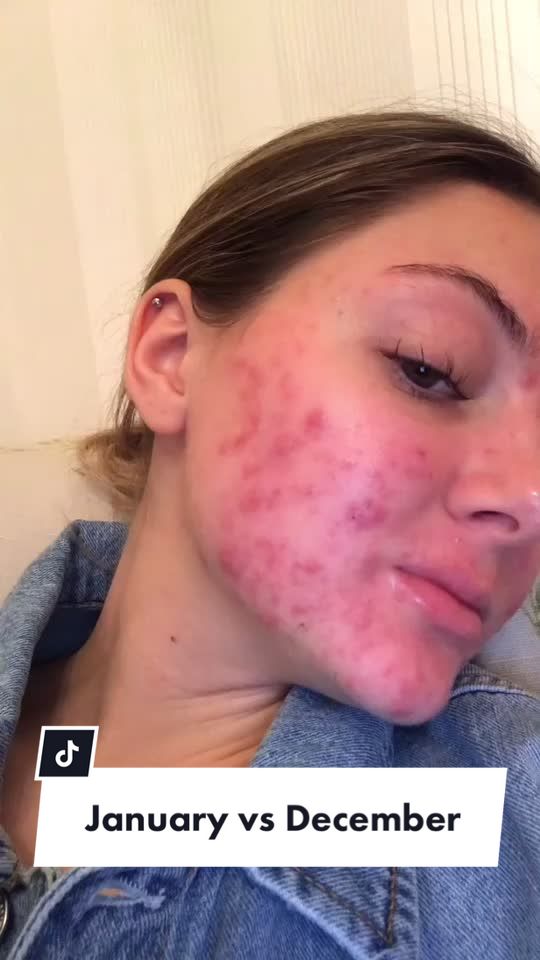 @Katyzzzle