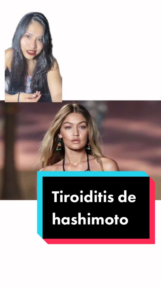 @Fabiana Abarca
