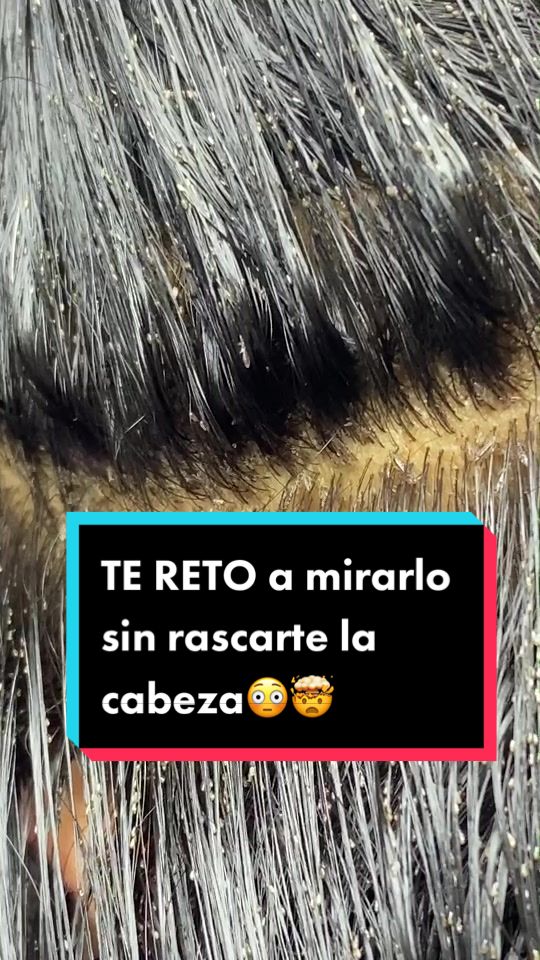 @Pppicas