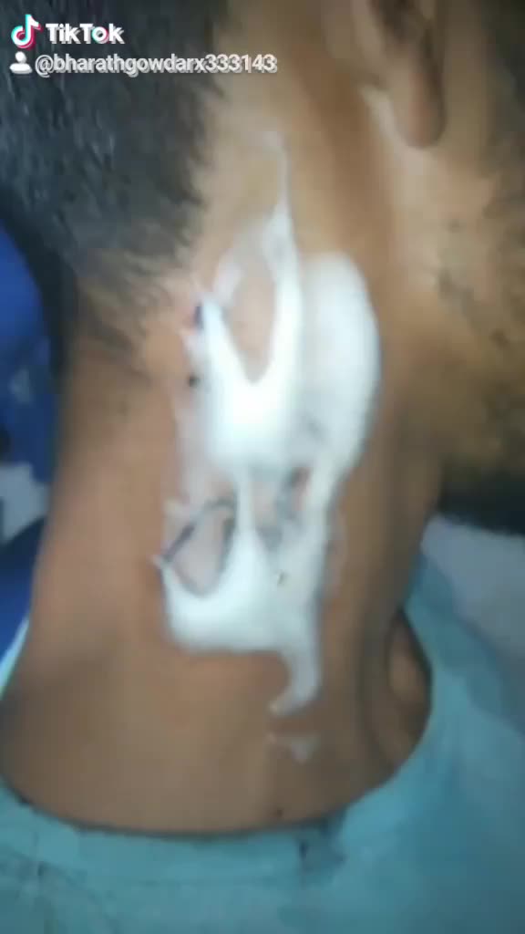 @Bharath Gowda Rx