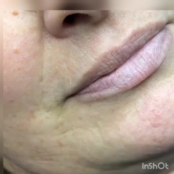 @Dott.ssa Veronica gezzi
