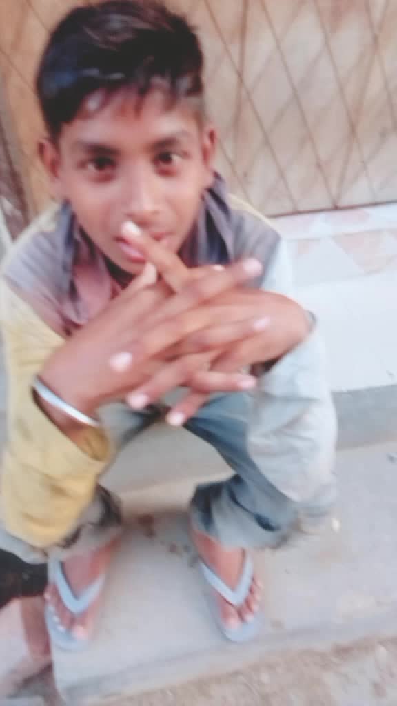 @Amit dost