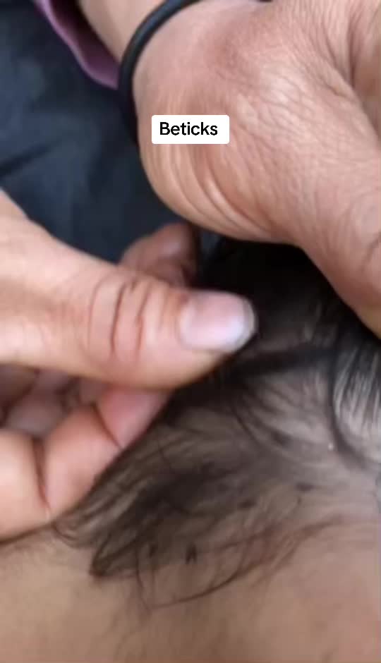 @bbbeee195