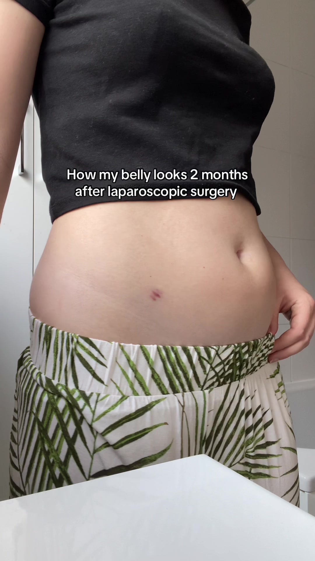@Chloe | Endo Diary🎗️